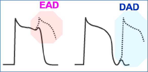 Early after-depolarisations and delayed after-depolarisations in Arrhythmias