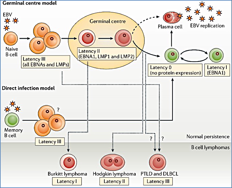 infectious mononucleosis (EBV) complications