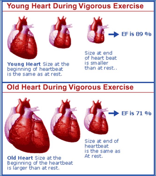 Ejection Fraction of young vs ageing hearts during exercise