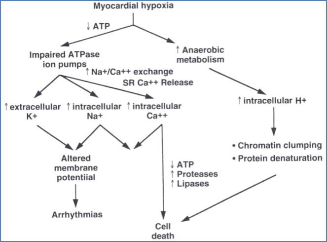Ion disturbances in ischaemic heart disease