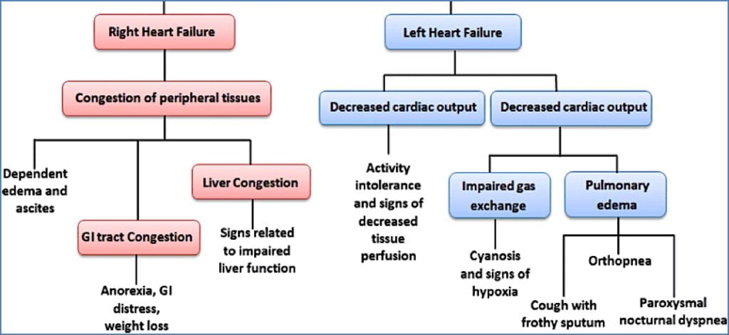 Right & Left sided heart failure
