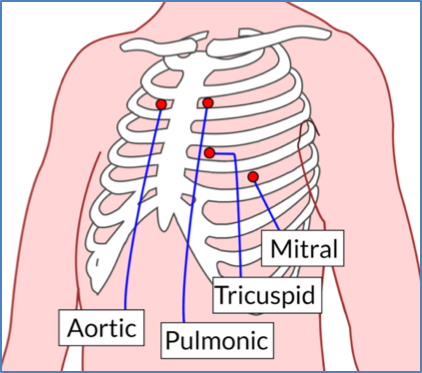 Where to Listen to Heart Sounds