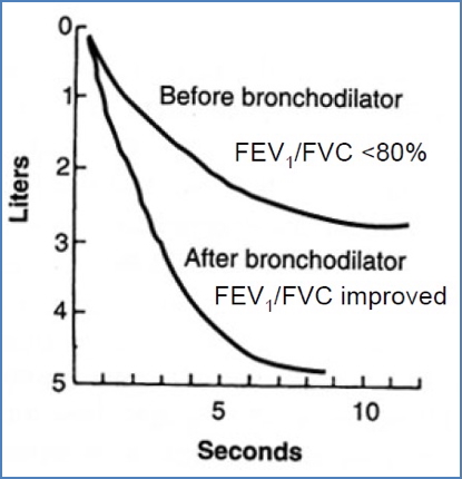 Airway Hypersensitivity and Asthma - Bronchodilator Response