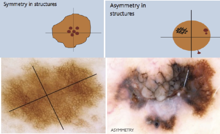 Asymmetry of Colour and /or Structure