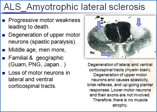 Motor Neurone Disease