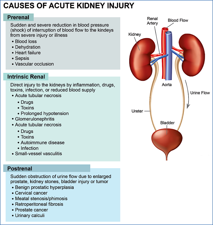 Acute Renal Failure - Causes