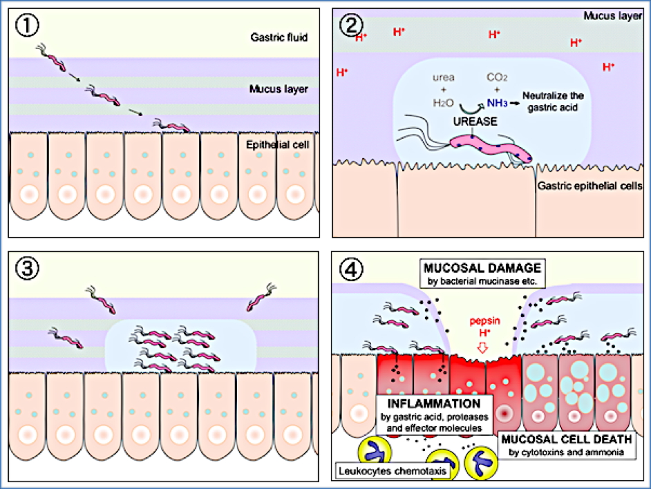 Helicobacter Pylori - Adaptations to a Hostile Environment