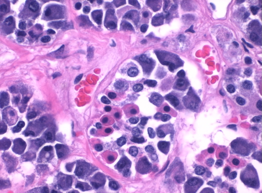 Anterior Pituitary Histology