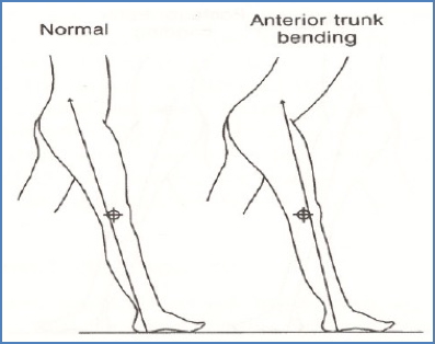 Anterior Trunk Bending