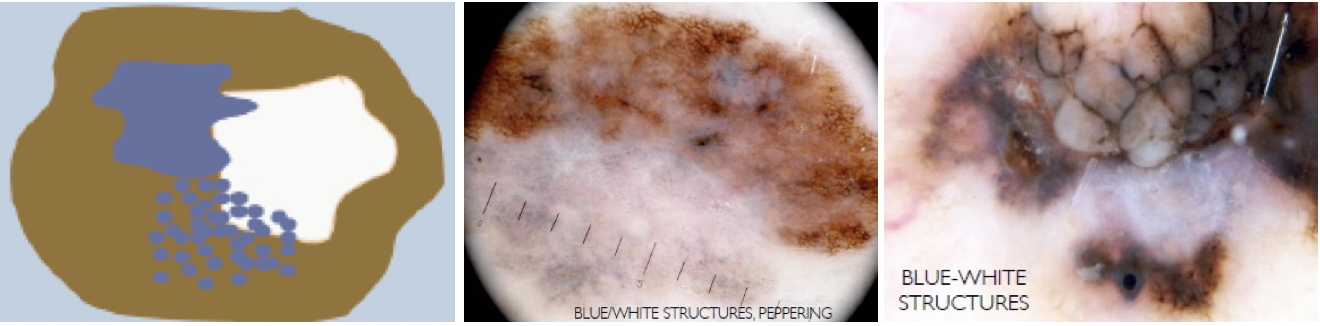 Blue-White Structures