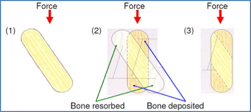 Bone Remodelling