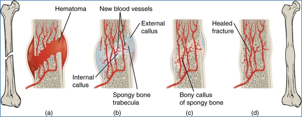 Bone repair mechanisms