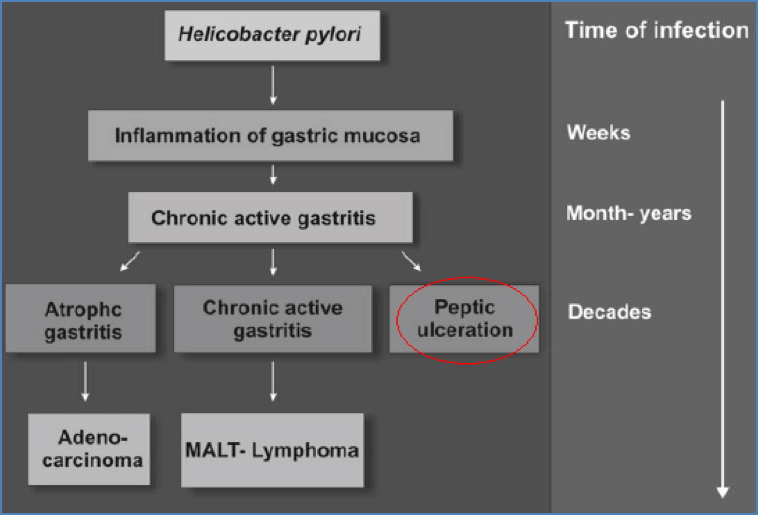 Helicobacter Pylori - Clinical Features
