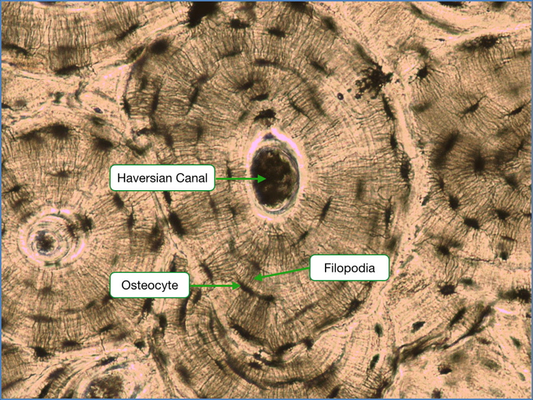 haversian canal, osteocytes, filopodia
