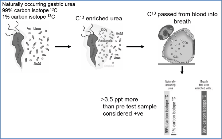 Helicobacter Pylori - Diagnosis