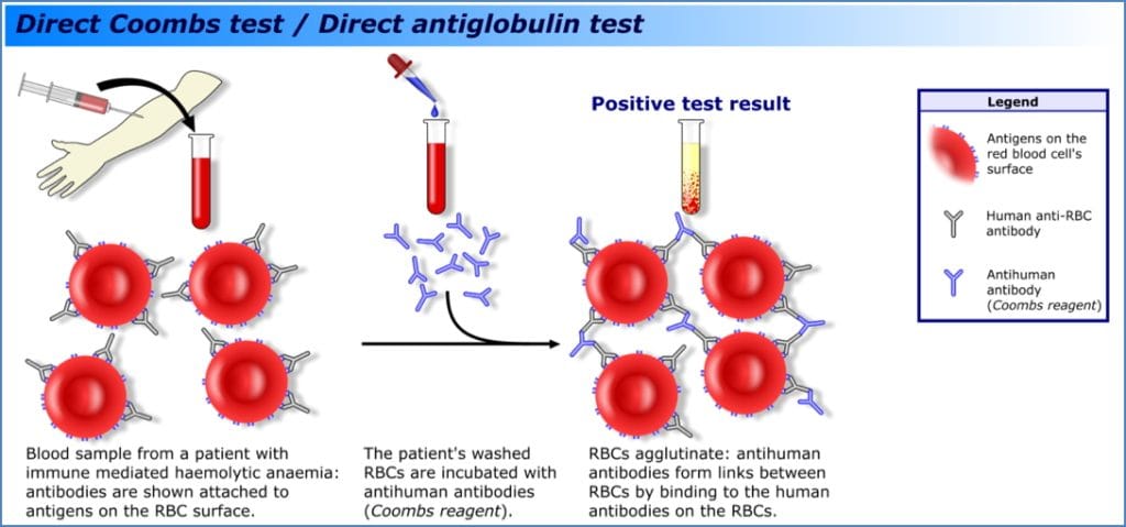 blood group compatibility - Direct Coombs