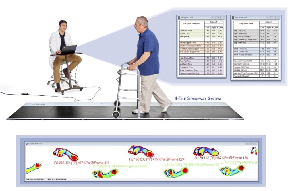 Gait Analysis