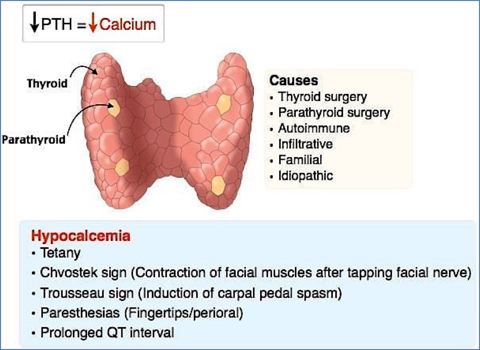 HYPOPARATHYROIDISM