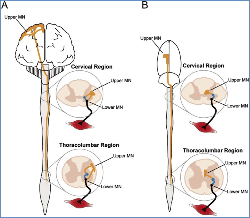 upper and lower motor neuron