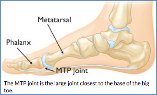 Lower Limb Joints - MTPJ
