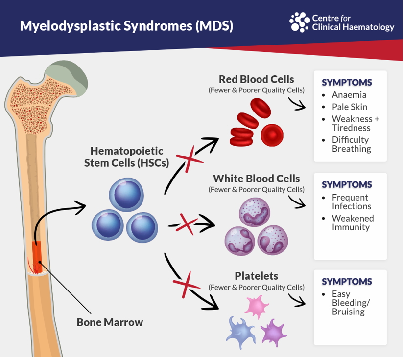 MYELODYSPLASTIC Syndromes