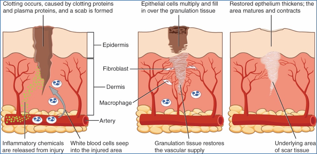 Mechanisms of Skin Healing