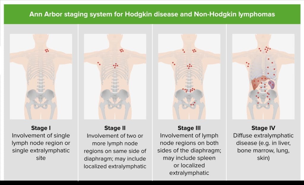 NON-HODGKIN’S LYMPHOMAS