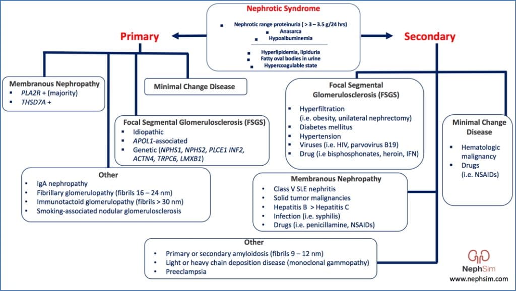 Numerous Types & Causes of Nephrotic Syndrome