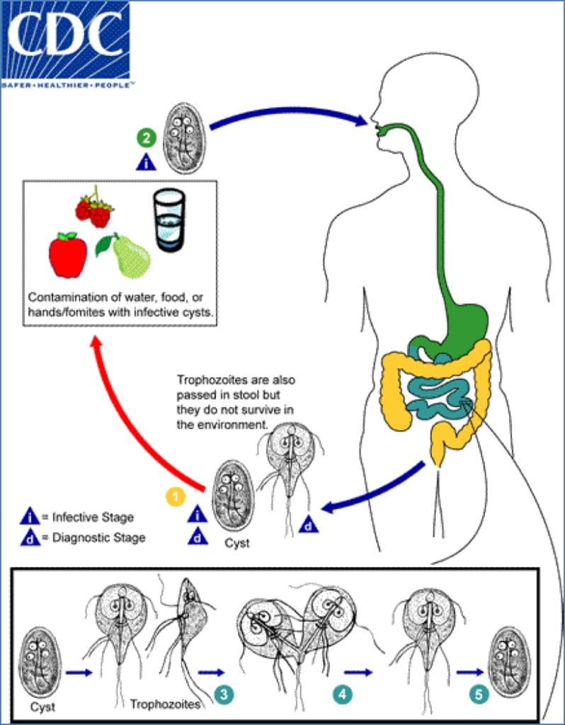 PARASITIC GUT INFECTIONS - Giardia