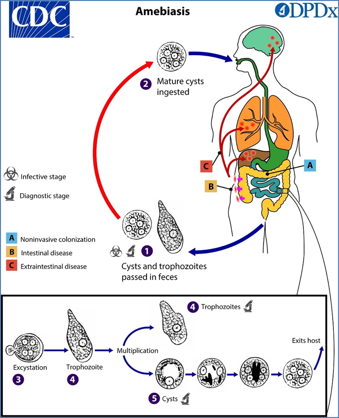 PARASITIC GUT INFECTIONS - Amebiasis