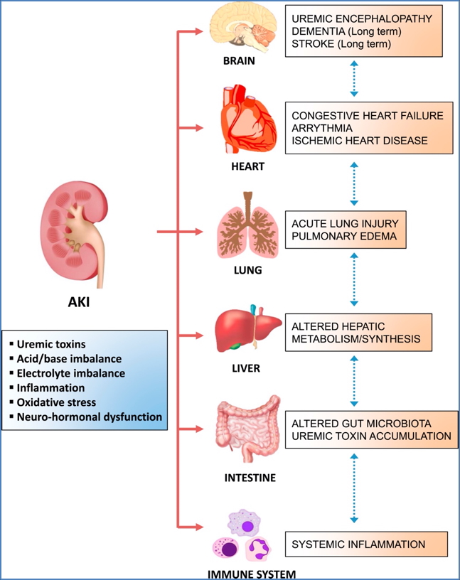 PRE-RENAL FAILURES