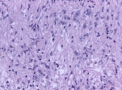 Posterior Pituitary Histology