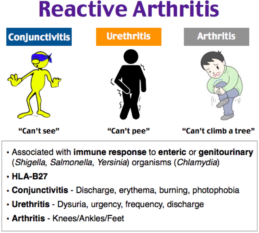 REACTIVE ARTHRITIS