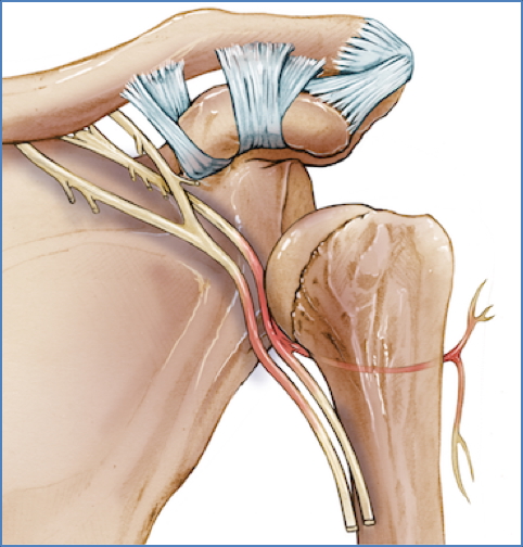 neurovascular compromise - Shoulder Dislocation