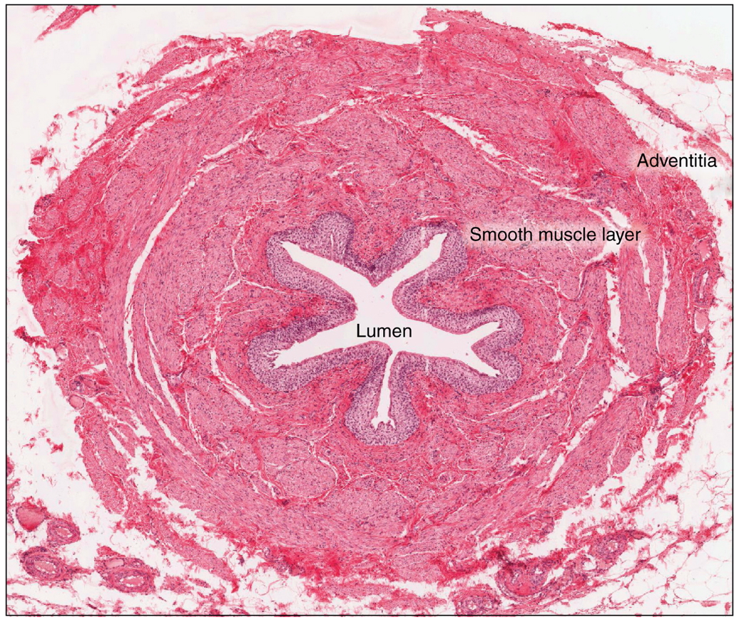 The Ureters