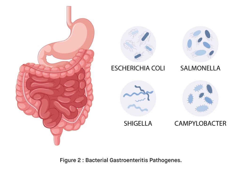 Bacterial Gastroenteritis