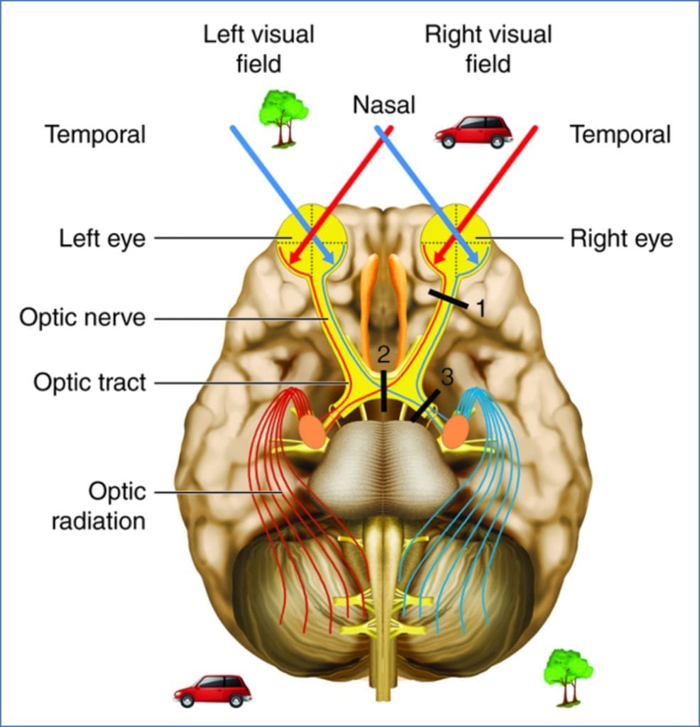 vision - visual fields