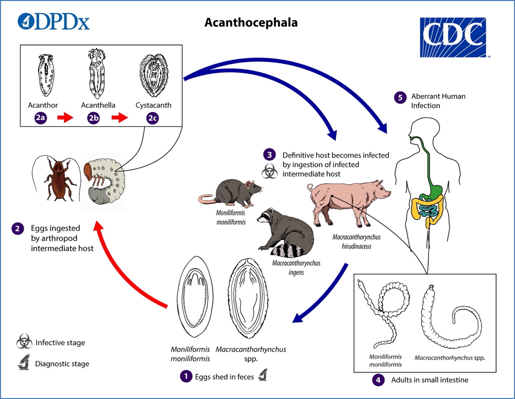microbiology of parasites: Acanthocephala
