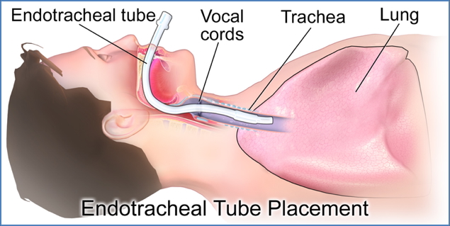 Advanced Interventions