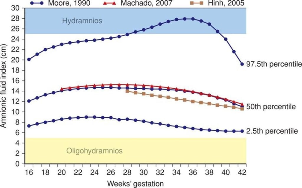 Amniotic Fluid Index - anomalies