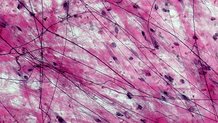 Areola Connective Tissue