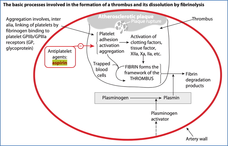 antiplatelet drugs: Aspirin