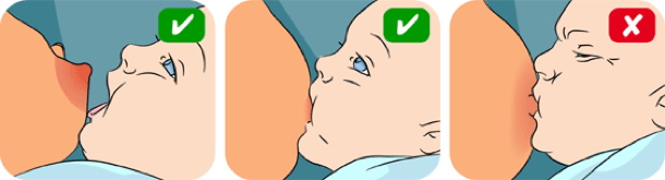 Attaching to the breast