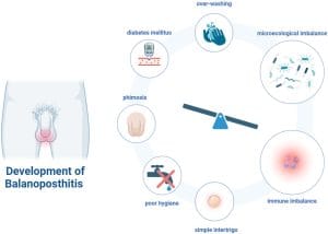 Balanitis and Balanoposthitis | Men's Health | MedStudentNotes