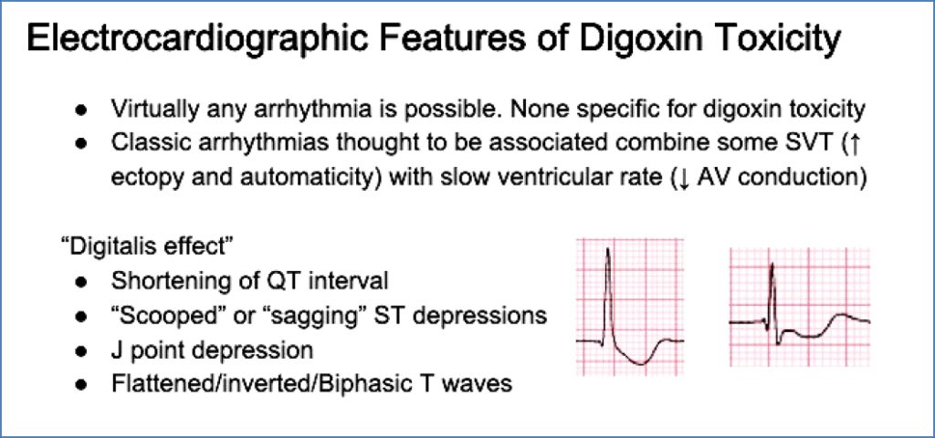 toxicity of common drugs: Digoxin Poisoning