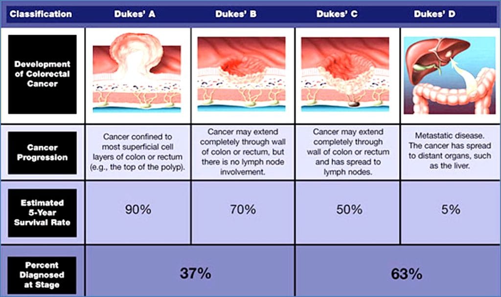 Colorectal Cancer Genetics Cancer MedStudentNotes Colorectal Cancer Genetics Cancer MedStudentNotes