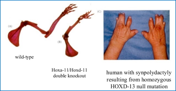 Egs Of Hox D Mal-Expression in Limb Development