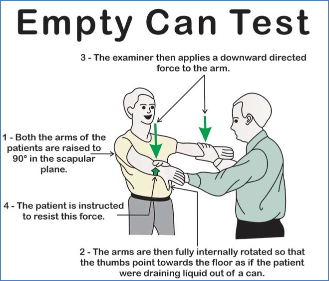 the musculoskeletal examination: Empty Can Test