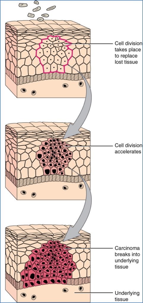 Cell Ageing and Cancer - General Characteristics of METASTATIC CANCERS