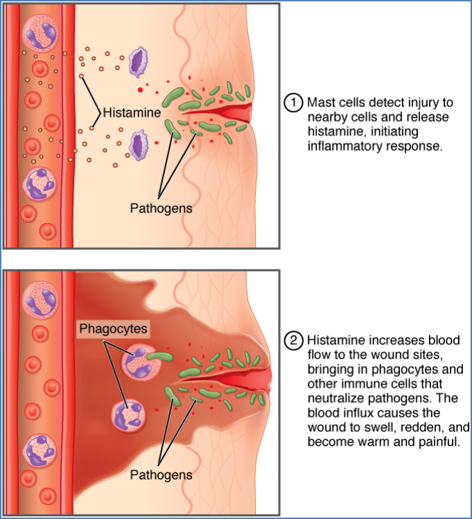 General Features of Inflammation